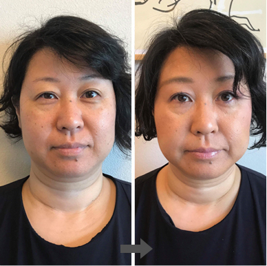 小顔&格上げメイク後