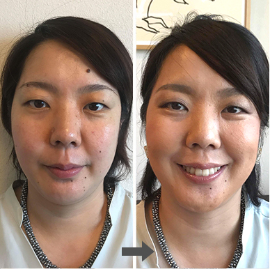 小顔&格上げメイク後