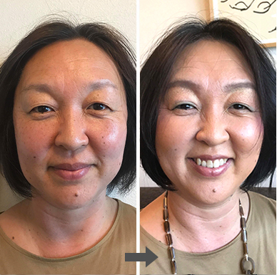 小顔&格上げメイク後