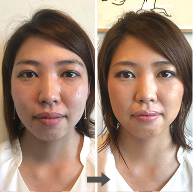 小顔&格上げメイク後